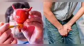 Si tienes más de 40 años y tienes problemas al miccionar entonces debes ir al médico.