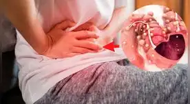 Conoce todo sobre el cáncer al colon