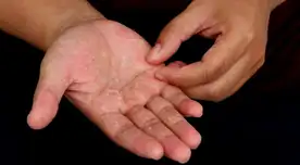 Procura no usar productos de higiene que tengan menos consevantes.