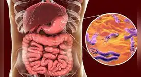 H. pylori: Es un microorganismo al que se le atribuye el desarrollo de cáncer de estómago.