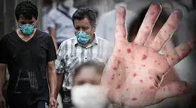 El INS advirtió que los casos no solo se encontrarían en cinco distritos, sino en toda Lima Metropolitana.