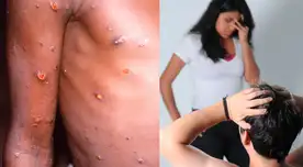 El jefe del INS, Víctor Suárez, recomendó acudir a un centro de salud en caso de presentar algún síntoma.