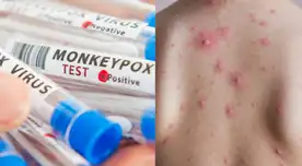 Ambas se caracterizan por causar erupciones en la piel.