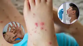 Conoce cuáles son las diferencias entre la viruela del mono, gripe del tomate y Covid-19.