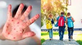 En el Perú hasta el momento solo se ha reportado el caso de un menos contagiado con la viruela del mono, según informó el Minsa. En el Perú hasta el momento solo se ha reportado el caso de un menos contagiado con la viruela del mono, según informó el Minsa.