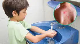 Si tu hijo presenta erupciones que se extienden a lo largo del cuerpo, llévalo a una evaluación con el médico. Si tu hijo presenta erupciones que se extienden a lo largo del cuerpo, llévalo a una evaluación con el médico.