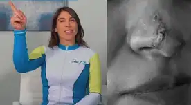 Descubre qué es el metacrilato la sustancia que puede tener graves consecuencias en las personas. Descubre qué es el metacrilato la sustancia que puede tener graves consecuencias en las personas.