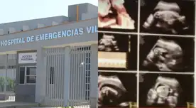 El Hospital de Emergencias de Villa El Salvador informó que la paciente llegó con siete meses de embarazo al nosocomio y entro por emergencias a raíz de la pérdida de líquido amniótico. El Hospital de Emergencias de Villa El Salvador informó que la paciente llegó con siete meses de embarazo al nosocomio y entro por emergencias a raíz de la pérdida de líquido amniótico.