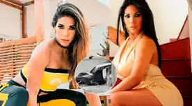 Karen Dejo asustada con pelicano enfermo en su condominio. Karen Dejo asustada con pelicano enfermo en su condominio.