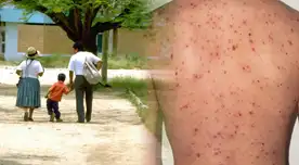 Minsa alista vacunación masiva.