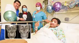 Menor que fue asaltado y le fracturaron 22 veces el rostro