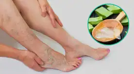 Si tienes un trabajo activo, utiliza medias de compresión.