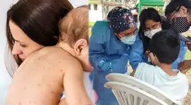 Bebé de 10 meses presenta Sarampión y se hizo un cerco epidemiológico en Surco.
