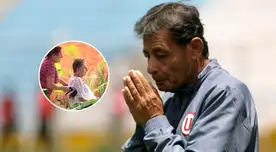 Roberto Chale: hija cuenta cómo se produjo la amputación de la pierna de su padre.