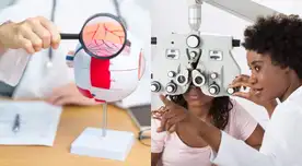 Para evitarla se deben controlar los niveles de azúcar en la sangre.