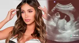 Paula Manzanal vuelve a salir embarazada luego de varios años. Paula Manzanal vuelve a salir embarazada luego de varios años.