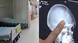 Negligencia médica en hospital de Villa María del Triunfo. Negligencia médica en hospital de Villa María del Triunfo.