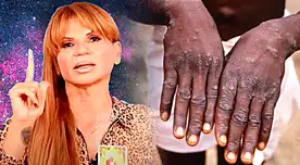 ¿Nueva pandemia? Mhoni Vidente alerta sobre el futuro de la viruela del mono.