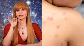 Mhoni Vidente sorprende con predicción sobre la viruela del mono. Mhoni Vidente sorprende con predicción sobre la viruela del mono.