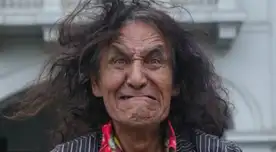 Mondonguito la pasa mal y pide ayuda para pagar su operación.