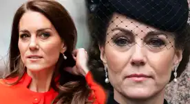 Se revela el misterio de la cicatriz de Kate Middleton.