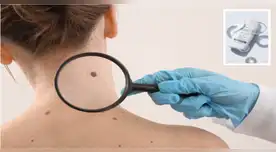 El uso del protector solar es fundamental estos días.