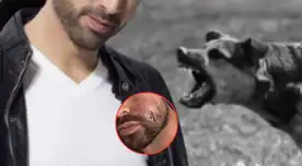Actor de Televisa tuvo que entrar a cirugía por la mordida de un perro.