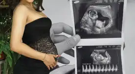 Influencer reveló inesperada noticia de su embarazo. Influencer reveló inesperada noticia de su embarazo.