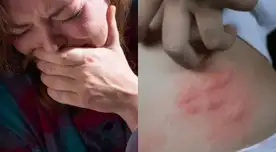 El INS alerta sobre un incremento en las mordeduras de araña casera durante la temporada de invierno.