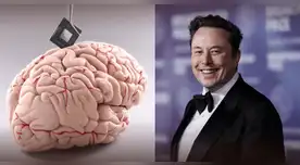 Elon Musk promete devolver la visión con chips cerebrales de Neuralink.