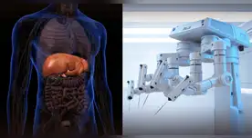 ChatGPT asiste en su primera operación robótica y realiza extirpación de vesícula exitosamente.