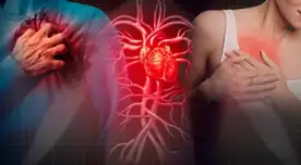 Aumentan casos de jóvenes que sufren de infarto: expertos alertan sobre causas silenciosas