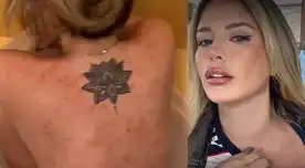 Flavia Laos PREOCUPA al revelar que tiene una ENFERMEDAD INCURABLE: “Mi cuerpo comenzó...”