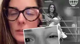 Rebeca Escribens preocupa al aparecer con un ojo CERRADO y PARALIZADO: Revela la complicada enfermedad que la ALEJA de América Espectáculos