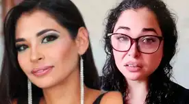 Melanie Martínez sorprende con sus resultados tras operación.