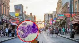 Se reportan más de 35 personas afectadas por un hongo peligroso en EE.UU. Se reportan más de 35 personas afectadas por un hongo peligroso en EE.UU.