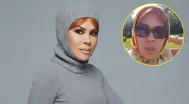 Magaly Medina vuelve a la pantalla chica y deja a todos hablando de su cirugía facial.