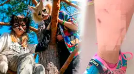 ¡Menor fue MORDIDA por THERIAN! MADRE denuncia que su hija fue MORDIDA por jóvenes que se creen ANIMALES: "Pensó que estaban bromeando" ¡Menor fue MORDIDA por THERIAN! MADRE denuncia que su hija fue MORDIDA por jóvenes que se creen ANIMALES: "Pensó que estaban bromeando"