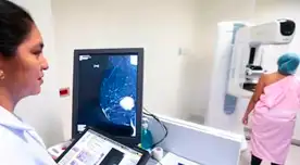 ¡SIN SEGURO Y SIN CITA! Minsa activa despistaje GRATUITO de cáncer en todo el Perú: revisa cómo acceder ¡SIN SEGURO Y SIN CITA! Minsa activa despistaje GRATUITO de cáncer en todo el Perú: revisa cómo acceder