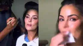 Laura Spoya expone las secuelas del choque que sufrió y explica por qué su diente sigue fracturado.