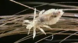 ¡Alerta en los colegios! Minsa advierte aumento de contagios de piojos y liendres.