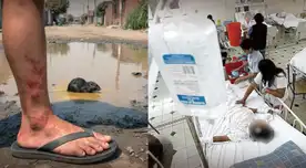 Cinco nuevos casos de leptospirosis fueron reportados en esta región: Minsa refuerza alerta epidemiológica.