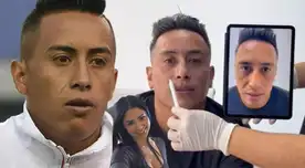 Christian Cueva se somete a tratamiento de MASCULINIZACIÓN por IMPENSADO motivo y muestra los resultados: "Me veía al espejo y..."