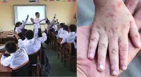 Brote de SARAMPIÓN obliga a suspender clases presenciales en esta ciudad del Perú. Brote de SARAMPIÓN obliga a suspender clases presenciales en esta ciudad del Perú.