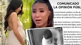 Samahara Lobatón lanza DURO COMUNICADO sobre el delicado estado de sus hijos tras agresión de Bryan Torres.