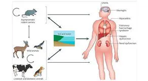 ¿Qué es la leptospirosis?