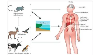 ¿Qué es la leptospirosis?