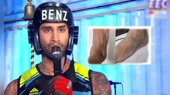 ¿Estará en la final de EEG? Jota Benz preocupa a sus seguidores al exponer estado crítico de su salud