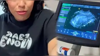 Conocida influencer peruana anunció su EMBARAZO y revela que será MADRE SOLTERA