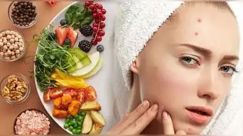 alimentos contra el acné